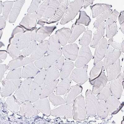 Immunohistochemistry-Paraffin: C1qTNF10/C1qL2 Antibody [NBP2-34090]