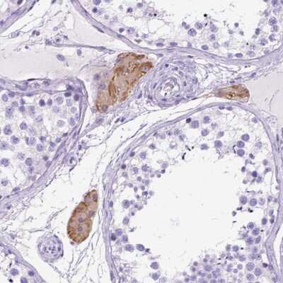 Immunohistochemistry: C1qTNF3/CORS26/CTRP3 Antibody [NBP2-49434]