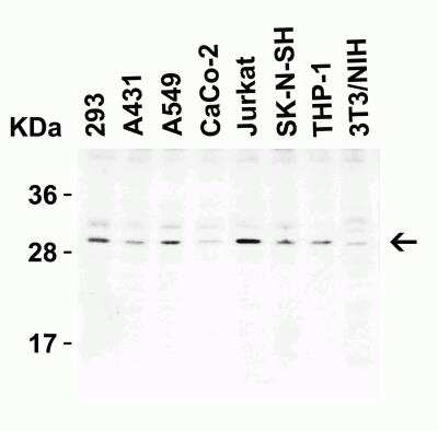 Western Blot: C1qTNF3/CORS26/CTRP3 AntibodyBSA Free [NBP1-76628]