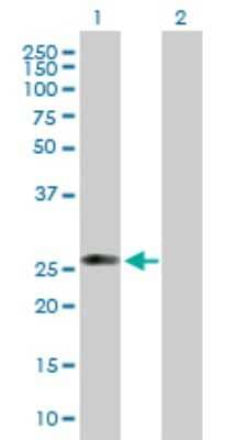 Western Blot: C1qTNF5/CTRP5 Antibody [H00114902-B01P]