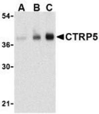 Western Blot: C1qTNF5/CTRP5 AntibodyBSA Free [NBP1-76631]