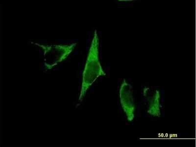 Immunocytochemistry/ Immunofluorescence: CTRP9/C1qTNF9 Antibody [H00338872-B01P]