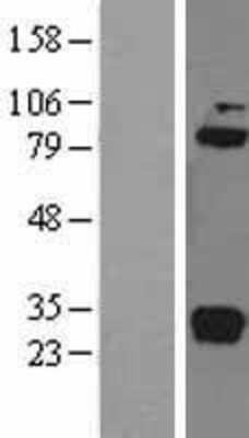 Western Blot: Complement Component C1r Overexpression Lysate [NBL1-08349]