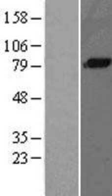 Western Blot: Complement Component C1s Overexpression Lysate [NBL1-08351]