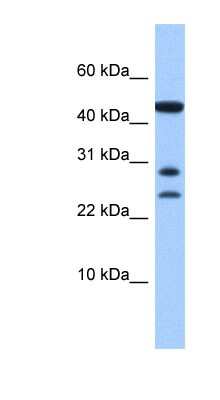 Western Blot: C20ORF141 Antibody [NBP1-56702]