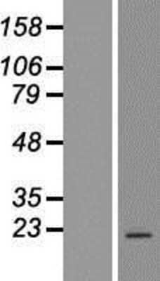 Western Blot: FAM209A Overexpression Lysate [NBL1-08355]