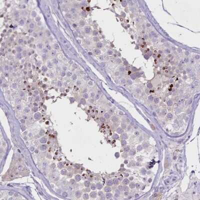 Immunohistochemistry-Paraffin: FAM209B Antibody [NBP1-84242]