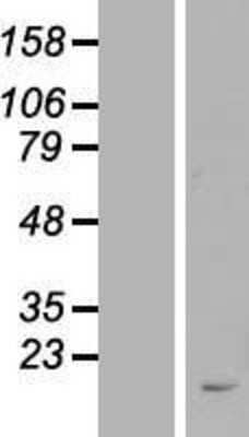 Western Blot: FAM209B Overexpression Lysate [NBL1-08356]