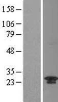 Western Blot: TWA1 Overexpression Lysate [NBL1-08357]