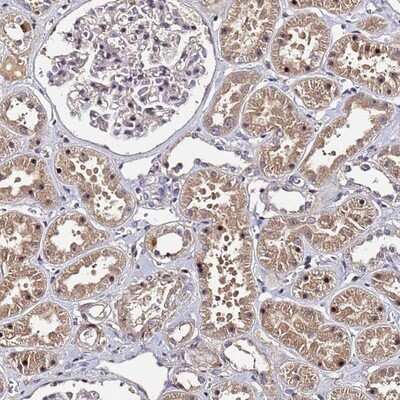 Immunohistochemistry-Paraffin: OSER1 Antibody [NBP1-91725]