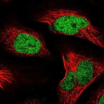 Immunocytochemistry/ Immunofluorescence: Nucleolar Protein 4 Like Antibody [NBP1-94115]