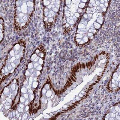 Immunohistochemistry: Nucleolar Protein 4 Like Antibody [NBP1-94114]