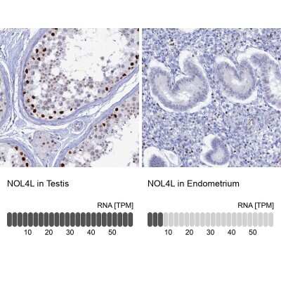 Immunohistochemistry-Paraffin: Nucleolar Protein 4 Like Antibody [NBP1-94114]