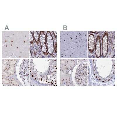 Immunohistochemistry-Paraffin: Nucleolar Protein 4 Like Antibody [NBP1-94114]