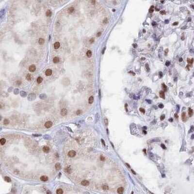 Immunohistochemistry-Paraffin: Nucleolar Protein 4 Like Antibody [NBP1-94114]