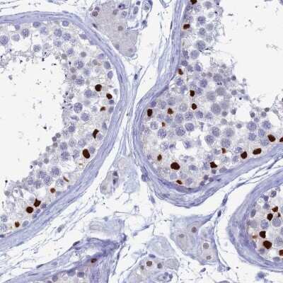 Immunohistochemistry-Paraffin: Nucleolar Protein 4 Like Antibody [NBP1-94115]
