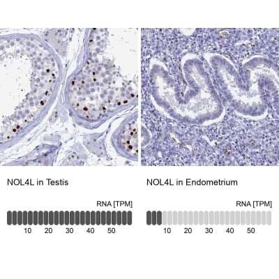 Immunohistochemistry-Paraffin: Nucleolar Protein 4 Like Antibody [NBP1-94115]