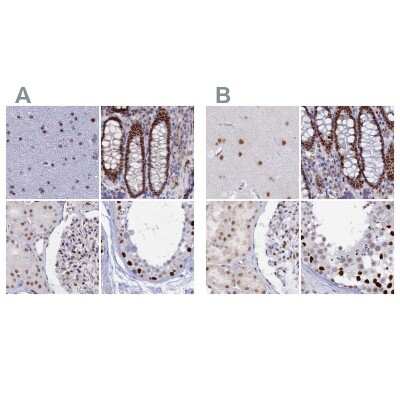 Immunohistochemistry-Paraffin: Nucleolar Protein 4 Like Antibody [NBP1-94115]