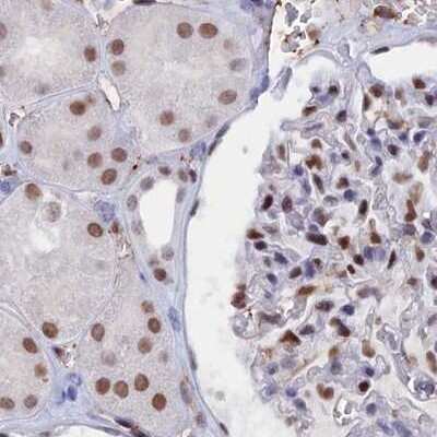 Immunohistochemistry-Paraffin: Nucleolar Protein 4 Like Antibody [NBP1-94115]