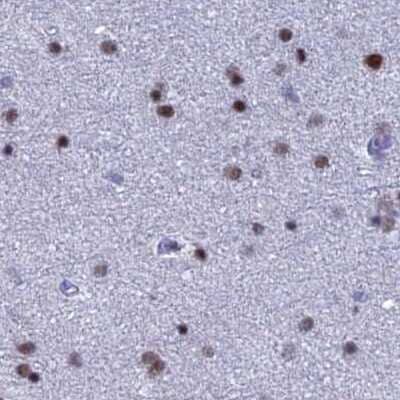 Immunohistochemistry-Paraffin: Nucleolar Protein 4 Like Antibody [NBP1-94115]