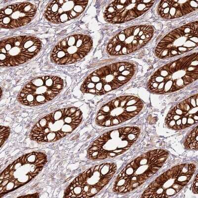 Immunohistochemistry-Paraffin: TLDC2 Antibody [NBP2-14595]