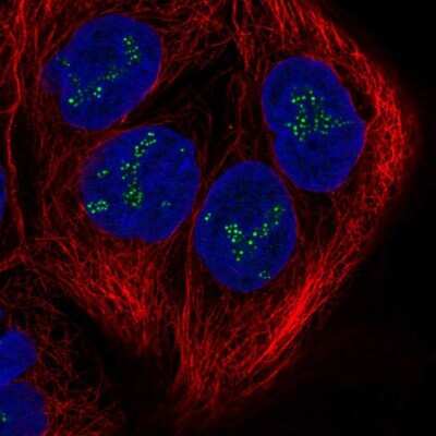 Immunocytochemistry/ Immunofluorescence: DZANK1 Antibody [NBP2-57571]