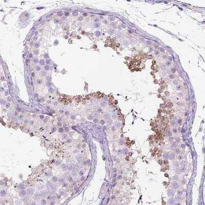 Immunohistochemistry-Paraffin: C20orf144 Antibody [NBP2-14398]