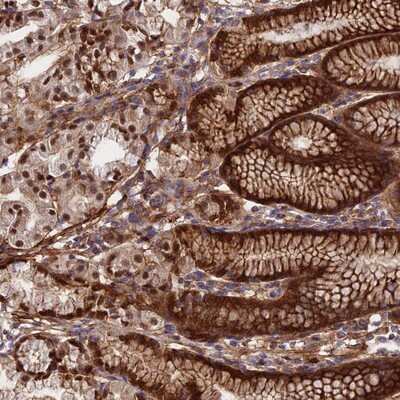 Immunohistochemistry-Paraffin: RBBP8 N-Terminal Like Antibody [NBP1-90563]