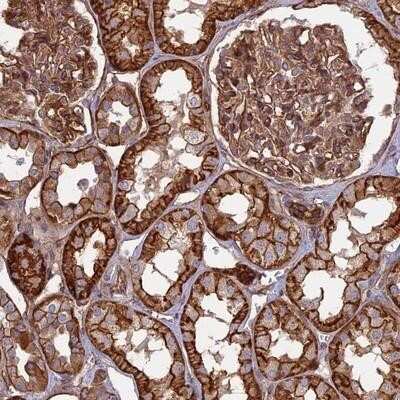 Immunohistochemistry-Paraffin: CNBD2 Antibody [NBP1-90562]