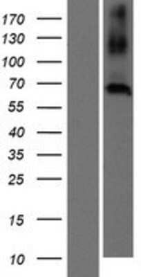 Western Blot: CNBD2 Overexpression Lysate [NBP2-05757]