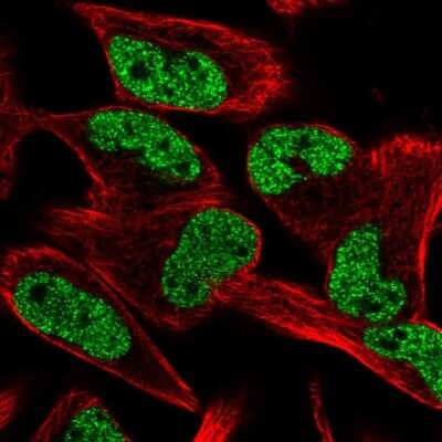 Immunocytochemistry/ Immunofluorescence: CCM2L Antibody [NBP2-58827]