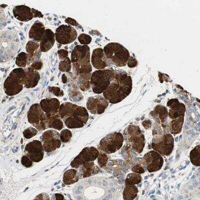 Immunohistochemistry-Paraffin: CCM2L Antibody [NBP1-84229]