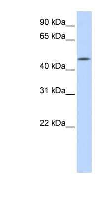 Western Blot: CCM2L Antibody [NBP1-70461]