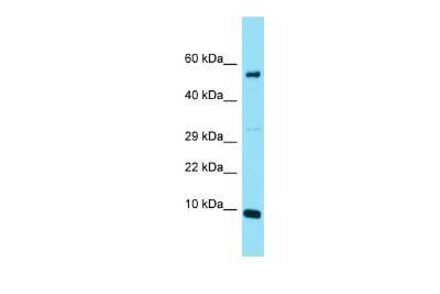 Western Blot: C20orf166 Antibody [NBP2-82876]