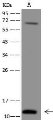 Western Blot: C20orf166 Antibody [NBP3-12639]