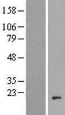 Western Blot: C20orf166 Overexpression Lysate [NBP2-04965]