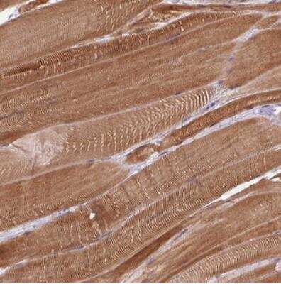 Immunohistochemistry: FAM65C Antibody [NBP2-30962]