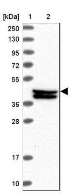 Western Blot: FAM217B Antibody [NBP1-94080]