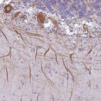 Immunohistochemistry-Paraffin: C20orf194 Antibody [NBP2-14759]