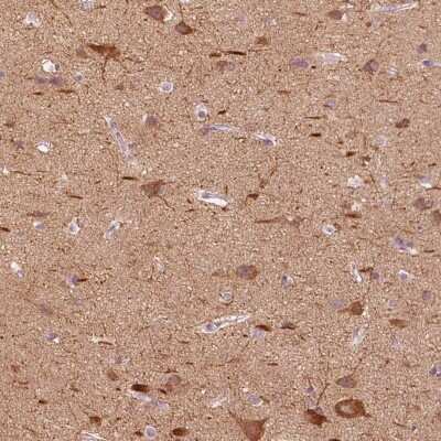 Immunohistochemistry-Paraffin: C20orf194 Antibody [NBP2-55754]