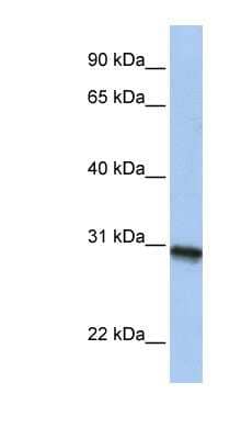 Western Blot: FNDC11 Antibody [NBP1-57700]