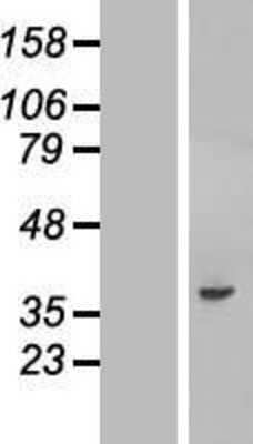 Western Blot: FNDC11 Overexpression Lysate [NBL1-08366]