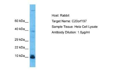 Western Blot: C20orf197 Antibody [NBP2-82878]