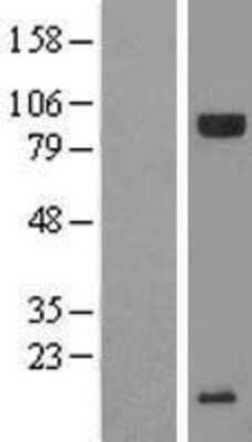 Western Blot: C20orf200 Overexpression Lysate [NBL1-08369]