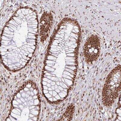 Immunohistochemistry-Paraffin: LKAAEAR1 Antibody [NBP2-49228]