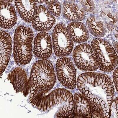 Immunohistochemistry-Paraffin: C20orf202 Antibody [NBP1-90964]