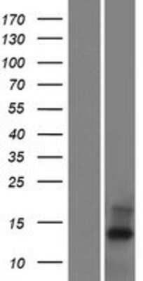 Western Blot: C20orf202 Overexpression Lysate [NBP2-09130]