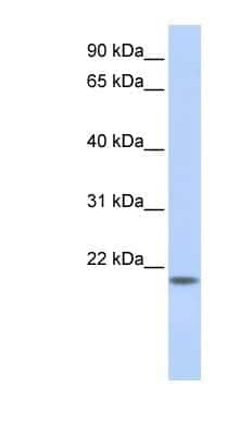 Western Blot: C20orf203 Antibody [NBP1-91545]