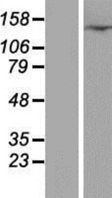 Western Blot: CFAP61 Overexpression Lysate [NBP2-07142]