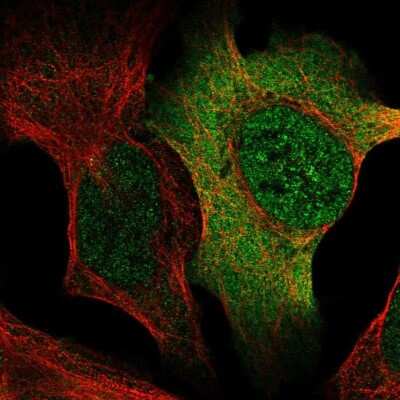 Immunocytochemistry/ Immunofluorescence: AP5S1 Antibody [NBP2-30509]